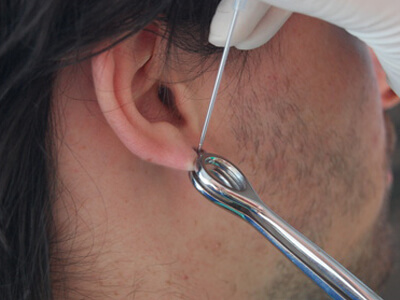 Im Percingstudio wird ein Piercing im Ohr angebracht.